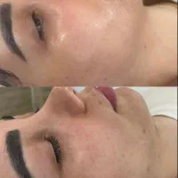 فیشال صورت و کفسابی