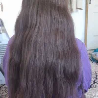 موی سر