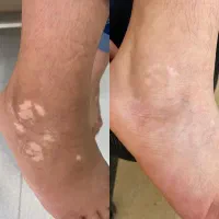 درمان قطعی و بدون بازگشت مشکلات پوستی|خدمات آرایشگری و زیبایی|مشهد, کلاهدوز|دیوار