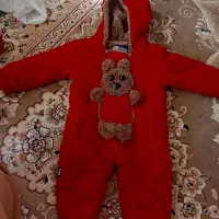 سر همی نوزاد