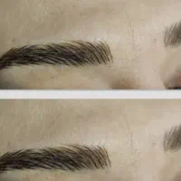 مدل زیبایی داعم صورت  رایگان