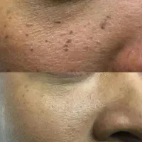 خال|خدمات آرایشگری و زیبایی|سرپل ذهاب, |دیوار