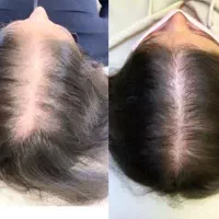 انجام کلیه خدمات فیشال و پاکسازی صورت