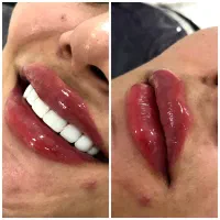 مدل جهت آپدیت و تکمیل البوم