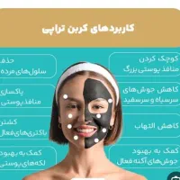 جلسه اول لیزر موهای زائد با کربن تراپی رایگان|خدمات آرایشگری و زیبایی|نجف‌آباد, شریعتی|دیوار