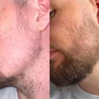 ریشات نیاز به یه حال حسابی داره