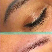 روشن شدن زیر بغل و زانو و آرنج با لیزر کیوسویچ|خدمات آرایشگری و زیبایی|کرج, گوهردشت|دیوار