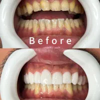 دندانپزشکی/لمینیت/ایمپلنت ( نصف قیمت تعرفه )|خدمات آرایشگری و زیبایی|تهران, فلسطین (میدان انقلاب)|دیوار