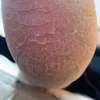 پدیکور وکف سابی پا(بانوان)