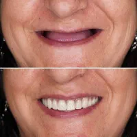 مرکز تخصصی دندانپزشکی ایمپلنت شرایط ویژه اقساطی|خدمات آرایشگری و زیبایی|تبریز, |دیوار