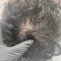 آموزش متد پولساز میکرو اسکالپ SMP