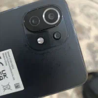 شیائومی می 11لایت