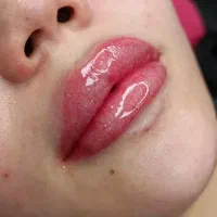 شیدینگ میکرو بن مژه گلشهر