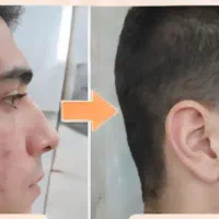 جوانساز با کرم بیوممتیک تحویل ۱ روزه