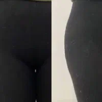 خدمات ژل .فیلر .فول بادی|خدمات آرایشگری و زیبایی|شیراز, پودنک|دیوار