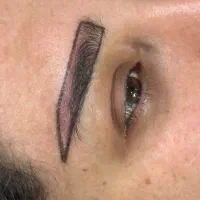 کاشت مو وابرو