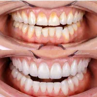مطب دندانپزشکی