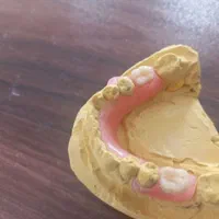 دندان مصنوعی وساخت انواع پروتز های متحرک|خدمات آرایشگری و زیبایی|لاهیجان, گلستان|دیوار