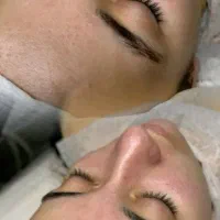 فیشال و پاکسازی پوست|خدمات آرایشگری و زیبایی|نیشابور, هفده شهریور|دیوار