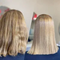 مدل پروتیین تراپی نانو مو تا سرشانه