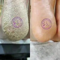 جشنواره تخفیفی ویژه خدمات واموزش پدیکورکلینیکال ‌