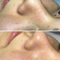 انجام کلیه خدمات پاکسازی پوست بصورت کاملا تخصصی|خدمات آرایشگری و زیبایی|سرپل ذهاب, |دیوار