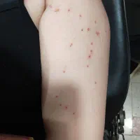 پلاسما .پلکسر|خدمات آرایشگری و زیبایی|زرند, |دیوار