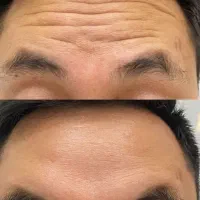 کامپوزیت دندان لیزرمو ژل بوتاکس فیلر مزو پی ارپی|خدمات آرایشگری و زیبایی|اسلامشهر, زرافشان|دیوار