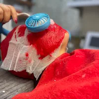 کرمپودر دائم و ژل و بوتاکس و هایفو