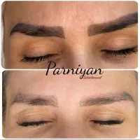 ریموو تاتو، پاک کردن تتو تخصصی کرج، البرز|خدمات آرایشگری و زیبایی|کرج, عظیمیه|دیوار