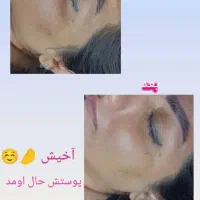 پاکسازی پوست .با بهترین متریال روز دنیا|خدمات آرایشگری و زیبایی|اصفهان, ملک‌شهر|دیوار