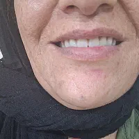 ساخت دندان|خدمات آرایشگری و زیبایی|خرمدره, |دیوار