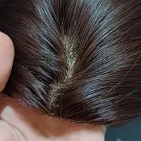 کلاه گیس(مو مصنوعی)|آرایشی، بهداشتی، درمانی|گرگان, |دیوار