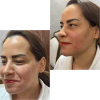فرصت ویژه آخر شهریور برای لاغری و زیبایی|خدمات زیبایی و سلامت|تهران, هفت حوض|دیوار