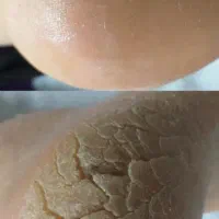 کاشت و ترمیم وپدیکور و مانیکور کفسابی تخصصی|خدمات آرایشگری و زیبایی|اراک, |دیوار