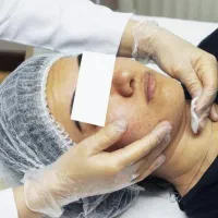 فیشیال حرفه‌ای پوست|خدمات آرایشگری و زیبایی|آباده, |دیوار