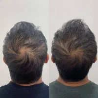 پی ار پی ممنوع