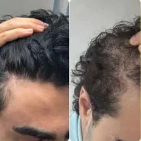 تنها نمایندگی اصلی شامپو مورینگا درتهران|آرایشی، بهداشتی، درمانی|تهران, شهرک رضویه|دیوار
