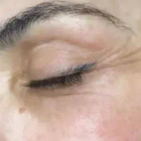کرم زرین الماس Vip|آرایشی، بهداشتی، درمانی|شیراز, پودنک|دیوار