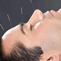 طب سوزنی تخصصی،حجامت،زالو درمانی،فصد،مزاج شناسی