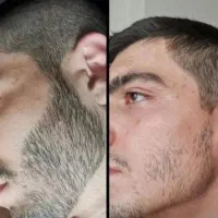 واقعا فکر کردی با کاشت درست میشه