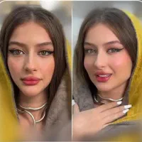 جوانسازی گردن بینی ژل دست فیلربادی باسن سینه آف۵۰٪