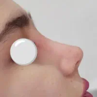 جراحی زیبایی بینی نقد و اقساط