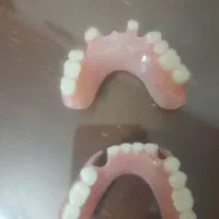 ساخت انواع دندان مصنوعی|خدمات آرایشگری و زیبایی|رشت, دروازه لاکان|دیوار