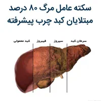 کبد چرب شما براحتی درمان می شود|خدمات آرایشگری و زیبایی|اصفهان, بیدآباد|دیوار