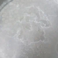 انجام طب سنتی صبح ناشتا باید باشید