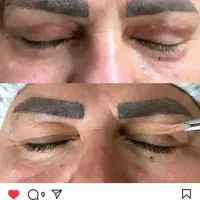 ژل .بوتاکس .هایفو.ساکشن غبغب وساکشن شکم وپهلو|خدمات آرایشگری و زیبایی|اصفهان, رکن الدوله غربی|دیوار
