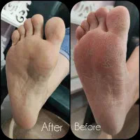 پدیکور درمانی و کف سابی +کاشت ناخن