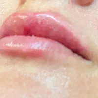 آموزش تخصصی بوتاکس و فیلر توسط پزشک متخصص|خدمات آموزشی|تهران, عباس‌آباد|دیوار