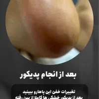 پدیکور تخصصی|خدمات آرایشگری و زیبایی|کرج, اتحاد|دیوار